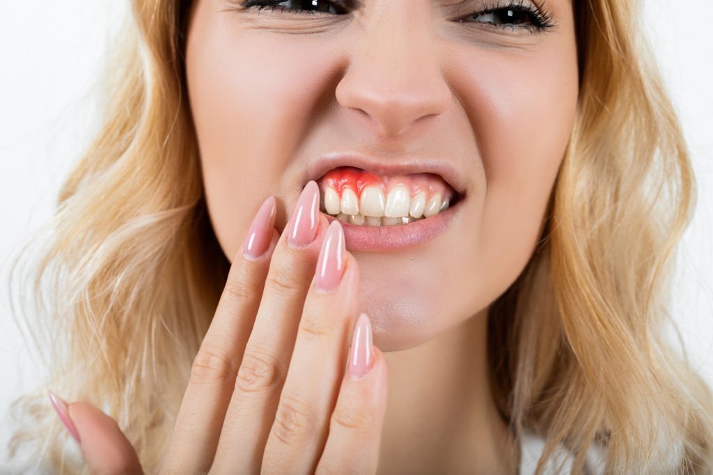 How Long Can You Keep Your Teeth with Periodontal Disease