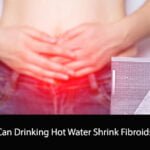 Can Drinking Hot Water Shrink Fibroids