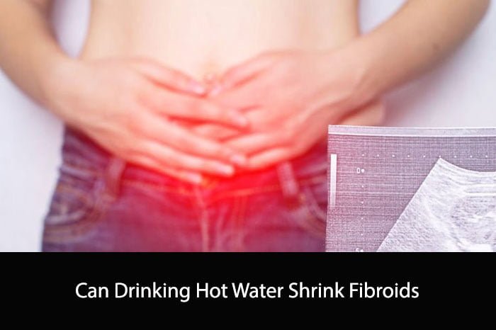 Can Drinking Hot Water Shrink Fibroids