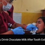Can You Drink Chocolate Milk After Tooth Extraction
