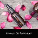 Essential Oils for Bunions