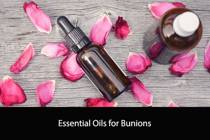 Essential Oils for Bunions