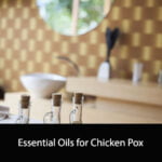Essential Oils for Chicken Pox