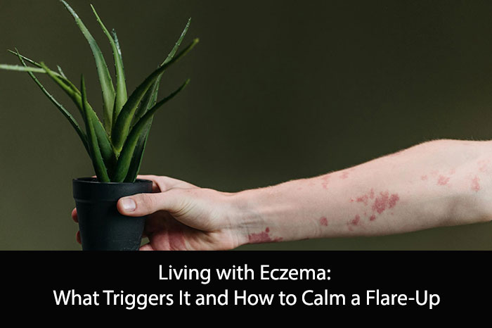 Living with Eczema: What Triggers It and How to Calm a Flare-Up